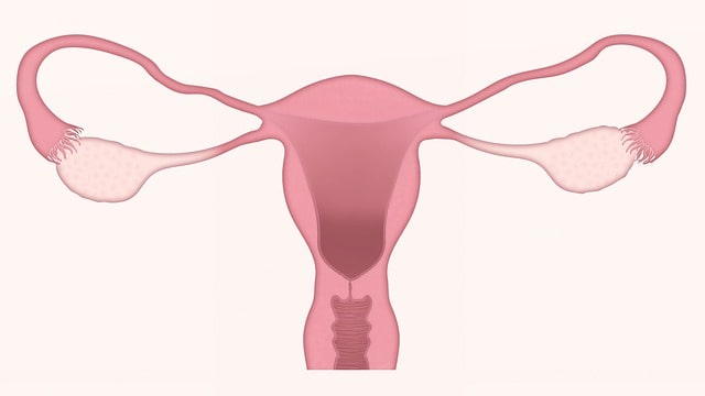 Hysterectomy cost in Mumbai